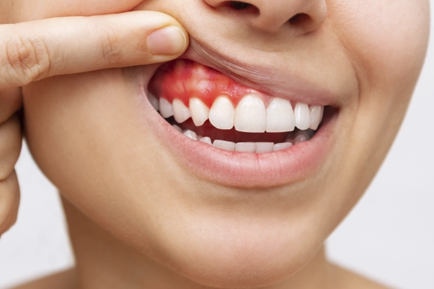 Periodontia